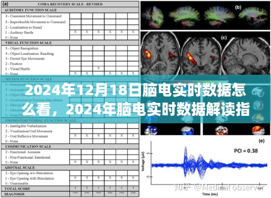 脑电实时数据解读指南,深度剖析与观点碰撞——2024年脑电数据解读与解析