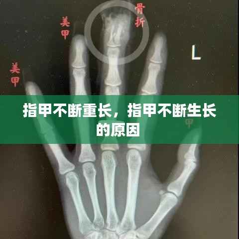 指甲不断重长,指甲不断生长的原因