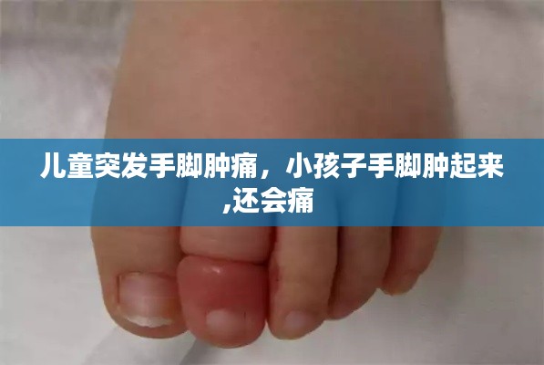 儿童突发手脚肿痛,小孩子手脚肿起来,还会痛