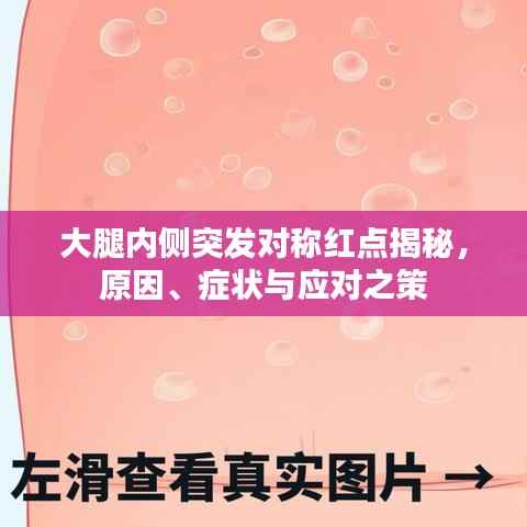 大腿内侧突发对称红点揭秘,原因、症状与应对之策