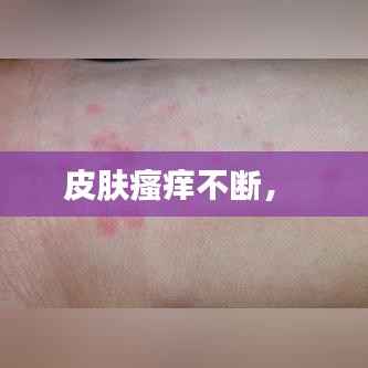 皮肤瘙痒不断,