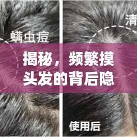 揭秘,频繁摸头发的背后隐藏的故事与心理解读